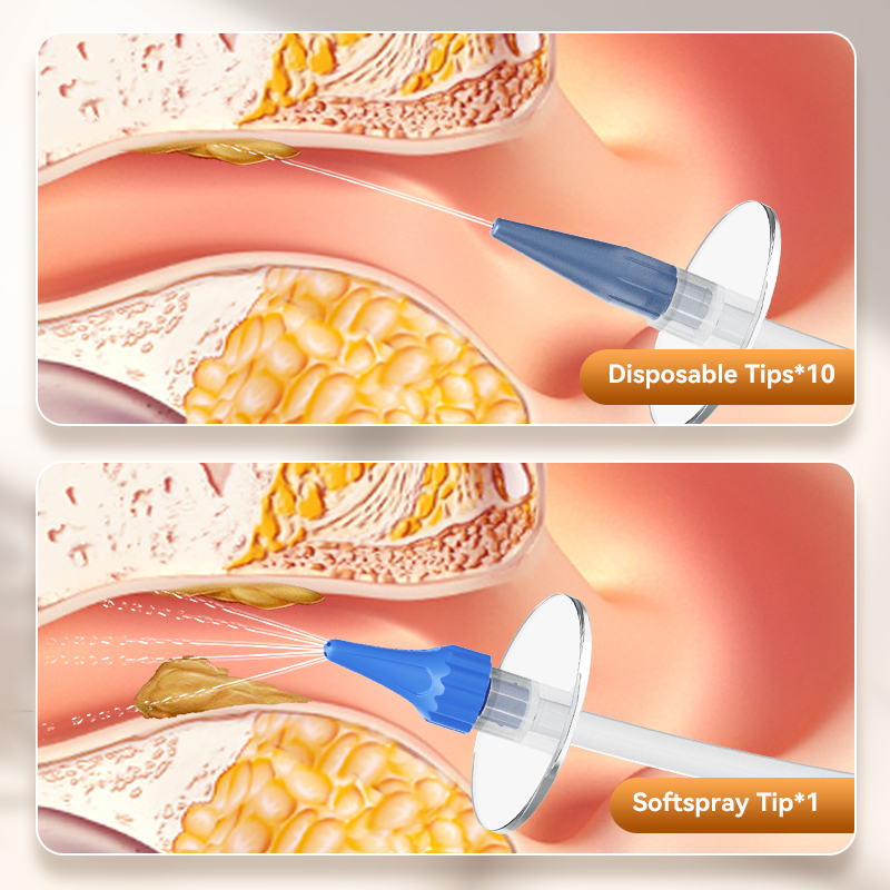 Ear Wax Removal Manual Ear Irr - Urban Farming System recensione e prezzo